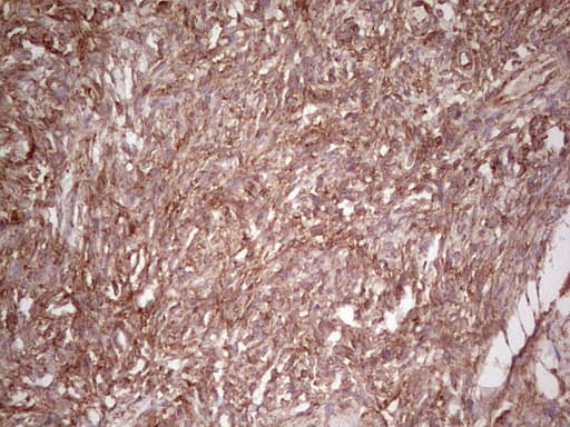 Monoclonal Mouse anti-Human WIBG Antibody (clone OTI5E2, IHC, WB)