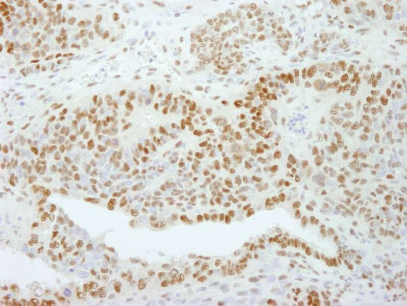 Polyclonal Rabbit anti-Human GTF2I / TFII I Antibody (aa985-998, IHC, IF)