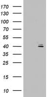 OTC Antibody (aa33-354, clone OTI3A5)