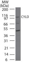 Polyclonal Rabbit anti-Human CYLD Antibody (aa32-45, WB)
