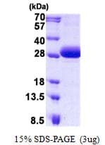 Human DGCR6 Protein (Recombinant His)