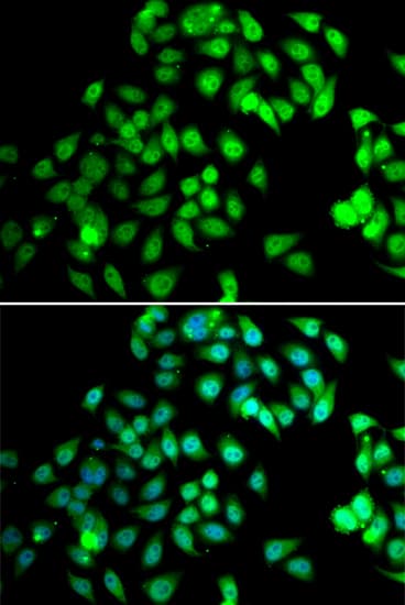 NCBP2 / CBP20 Antibody