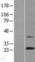ZNF625 Protein (Over-Expression Lysate Myc-DDK (Flag))