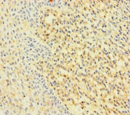 RAC2 Antibody
