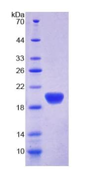 Human APOL2 / Apolipoprotein L 2 (Recombinant His-T7)