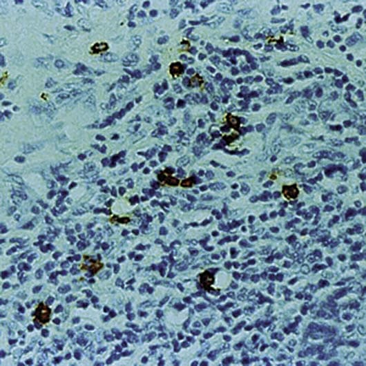 TPSAB1 / Mast Cell Tryptase Antibody (clone AA1)