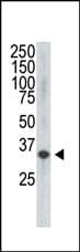 VEGFD Antibody (clone 28AT743.288.48)