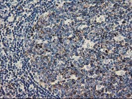 ERIC-1 / TACC3 Antibody (clone OTI8B7)