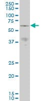Monoclonal Mouse anti-Human PAK3 Antibody (clone 1H7, IF, WB)