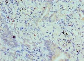 BIK Antibody (aa1-130)