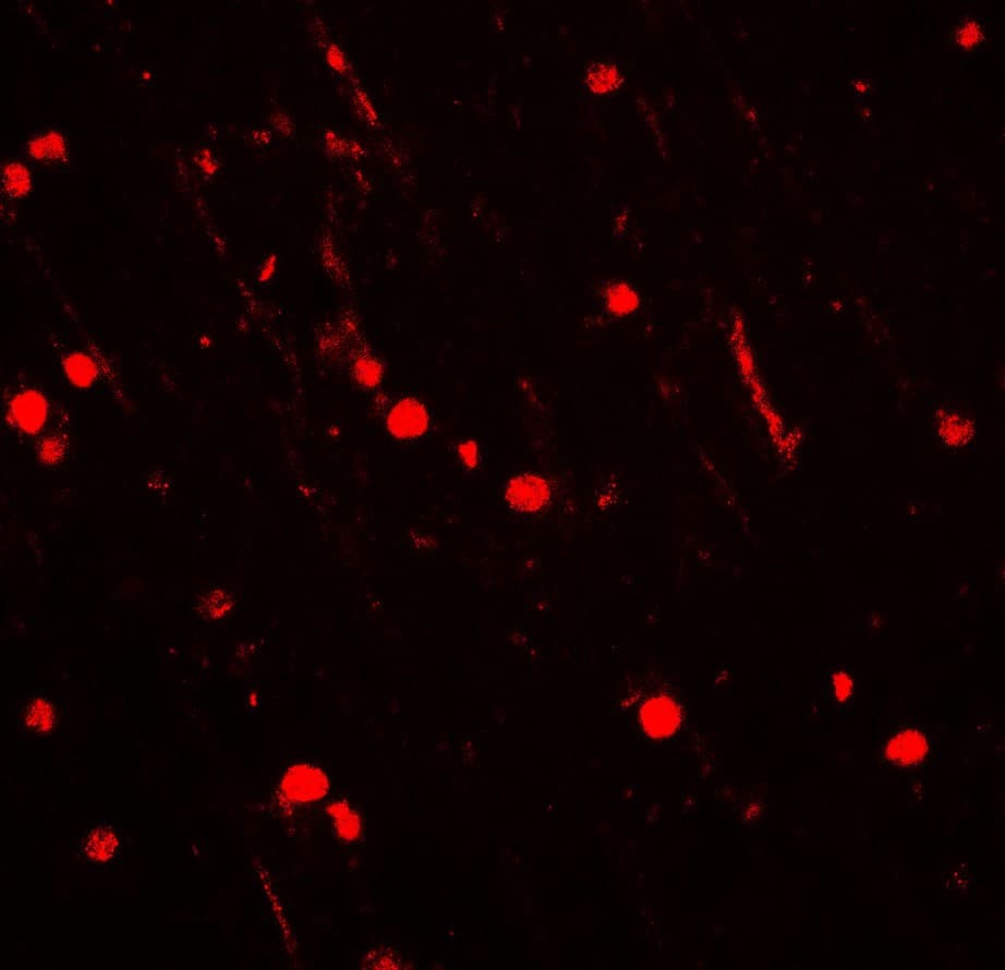 CYBB / NOX2 / gp91phox Antibody