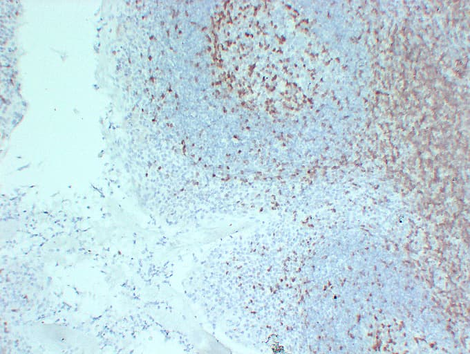 ZAP70 Antibody (clone ABT-ZAP70)