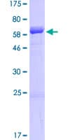 Human SDF4 Protein (Recombinant GST)