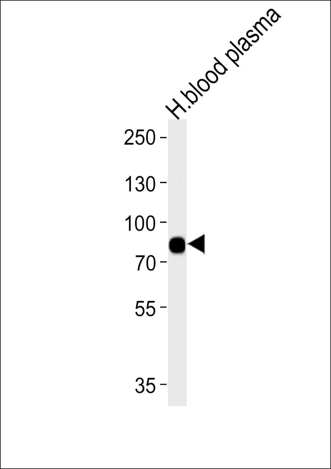 LRRC45 Antibody (aa615-643)