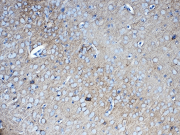 Polyclonal Rabbit anti-Human NCAN / Neurocan Antibody (IHC, WB)