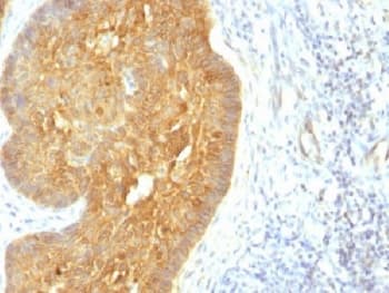 Monoclonal Mouse anti-Human MAML2 Antibody (clone MAML2/1302, Azide-free,BSA-free, IHC, IF, WB)