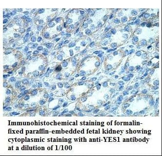 Polyclonal Rabbit anti-Human YES1 / c-Yes Antibody (aa416-538, IHC, WB)
