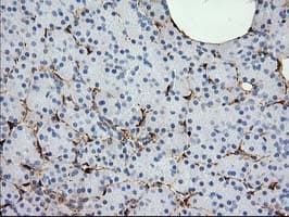 ADH2 / ADH1B Antibody (clone OTI3F2)