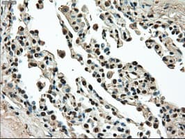 Monoclonal Mouse anti-Human TYRO3 Antibody (clone OTI2G2, IHC, WB)