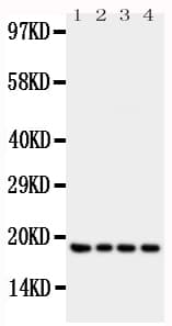 Polyclonal Rabbit anti-Human IFN Gamma / Interferon Gamma Antibody (aa151-166, WB)