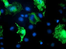 DOK7 Antibody (clone OTI4C6, Carrier-free)