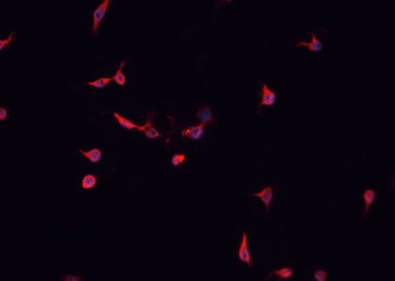 CDKL4 Antibody