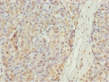 Polyclonal Rabbit anti-Human MYO5C Antibody (IHC)