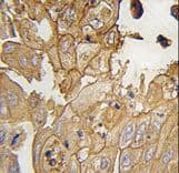 Polyclonal Rabbit anti-Human GMFG Antibody (aa1-30, IHC, WB)