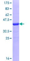Human CAGE1 / Cancer Antigen 1 Protein (Recombinant GST, N-terminus)