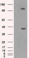 Monoclonal Mouse anti-Human LOX / Lysyl Oxidase Antibody (clone OTI5C4, IHC, IF, WB)