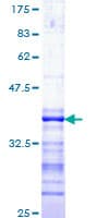 Human TAOK1 / TAO1 Protein (Recombinant GST, N-terminus)