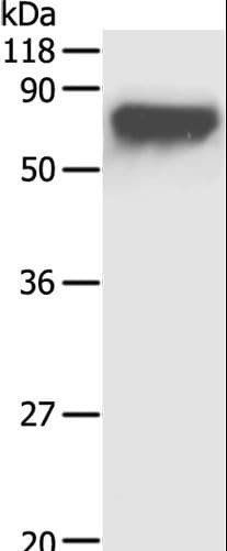 Alpha-Fetoprotein Antibody