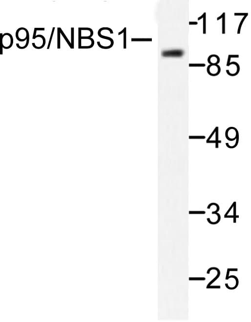NBN / Nibrin Antibody (Thr337)
