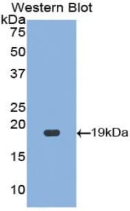 HIF1A / HIF1 Alpha Antibody (aa238-389)