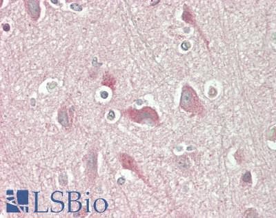 IHC-plus™ Polyclonal Rabbit anti-Human EPN2 Antibody (Internal, IHC, WB)