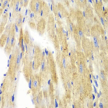 IHC-plus™ KRT19 / CK19 / Cytokeratin 19 Antibody