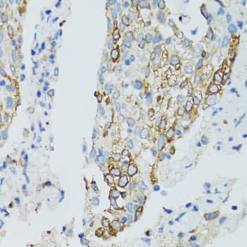 SIRT2 / Sirtuin 2 Antibody