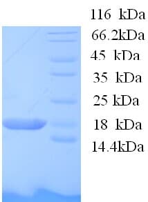 Human BOLA1 Protein (Recombinant His)