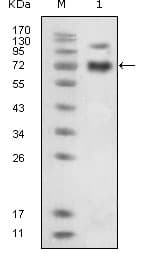 IHC-plus™ Monoclonal Mouse anti-Human EPHB4 / EPH Receptor B4 Antibody (clone 5B5, Extracellular, IHC, IF, WB)