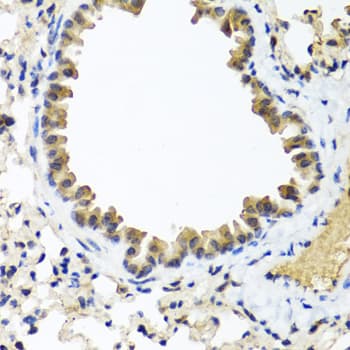 IFNL1 / IL29 Antibody