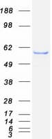 Human LPCAT1 / AYTL2 Protein (Recombinant Myc-DDK (Flag))