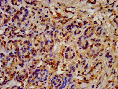Polyclonal Rabbit anti-Human HSP90AB1 / HSP90 Alpha B1 Antibody