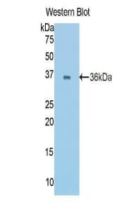 CDH1 / E Cadherin Antibody (aa374-628)