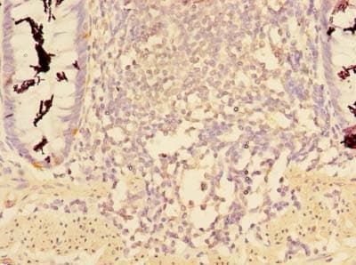 CCDC112 / MBC1 Antibody (Coiled-coil domain)