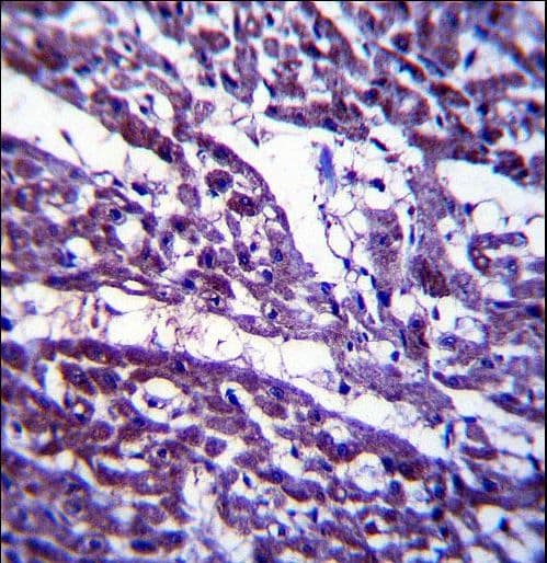 TUBGCP5 / GPC5 Antibody (aa172-201)