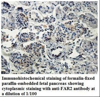 Polyclonal Rabbit anti-Human FAR2 Antibody (aa111-267, IHC, WB)