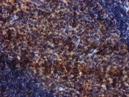 Complement C1s Antibody (clone OTI4E3)