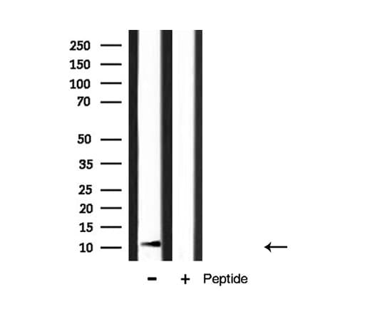 Polyclonal Rabbit anti-Human S100A4 / FSP1 Antibody (WB)