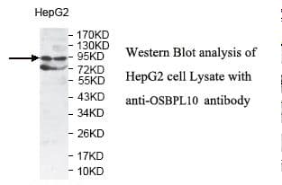 OSBPL10 Antibody (aa340-622)