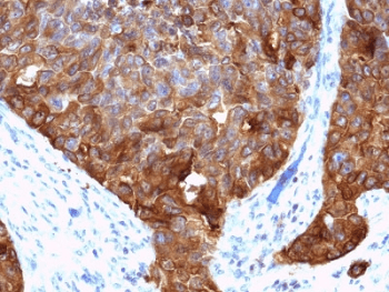 EMA / MUC1 Antibody (clone VU-4H5, Ready-to-Use)